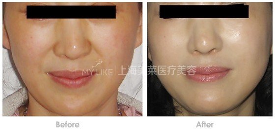 其实,“变老”只是一道选择题而已!
